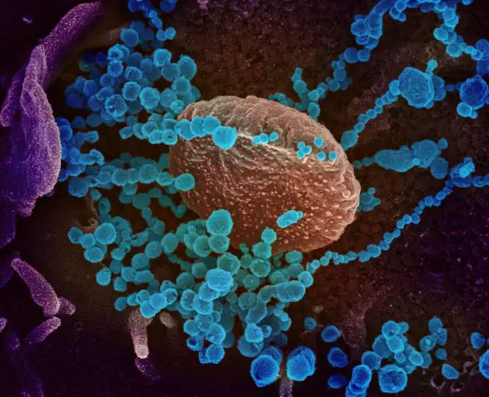 This scanning electron microscope image shows SARS-CoV-2 (round blue objects) emerging from the surface of cells cultured in the lab. SARS-CoV-2, also known as 2019-nCoV, is the virus that causes COVID-19. The virus shown was isolated from a patient in the U.S. Credit: NIAID-RML