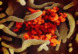 This scanning electron microscope image shows SARS-CoV-2 (orange)—also known as 2019-nCoV, the virus that causes COVID-19—isolated from a patient in the U.S., emerging from the surface of cells (green) cultured in the lab. Credit: NIAID-RML