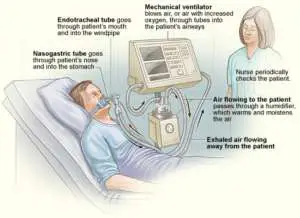 What a ventilator does